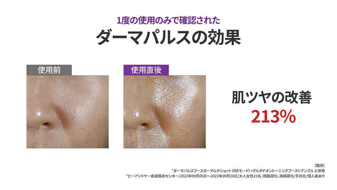 センテリアン24ダーマパルスブースターインジェクション